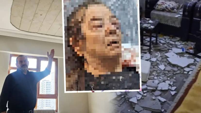 Evinde televizyon izlerken dehşeti yaşadı! Tavan çöktü, bir gözünü kaybetti