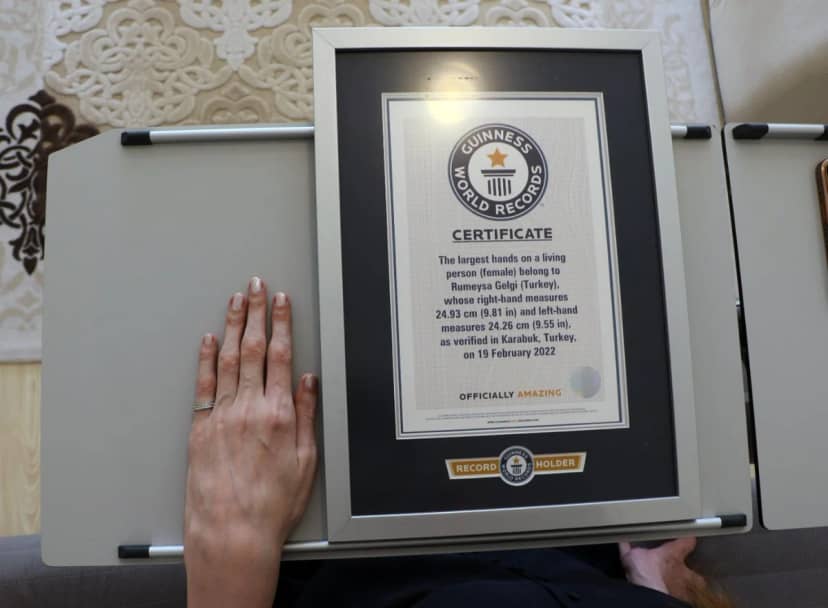 12 yılda 8 dünya rekoru! Dünyanın en uzun boylu kadını yine Guinness Rekorlar Kitabı'nda, hastalığının ismi değişti