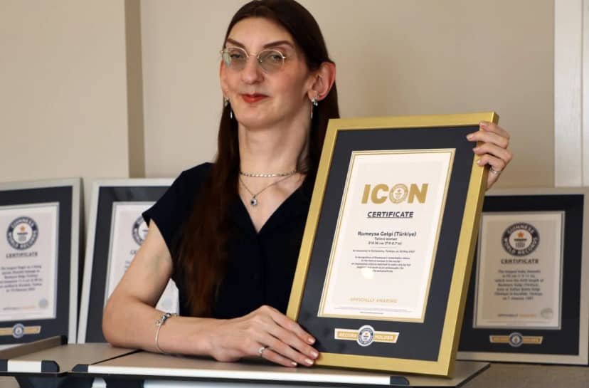 12 yılda 8 dünya rekoru! Dünyanın en uzun boylu kadını yine Guinness Rekorlar Kitabı'nda, hastalığının ismi değişti