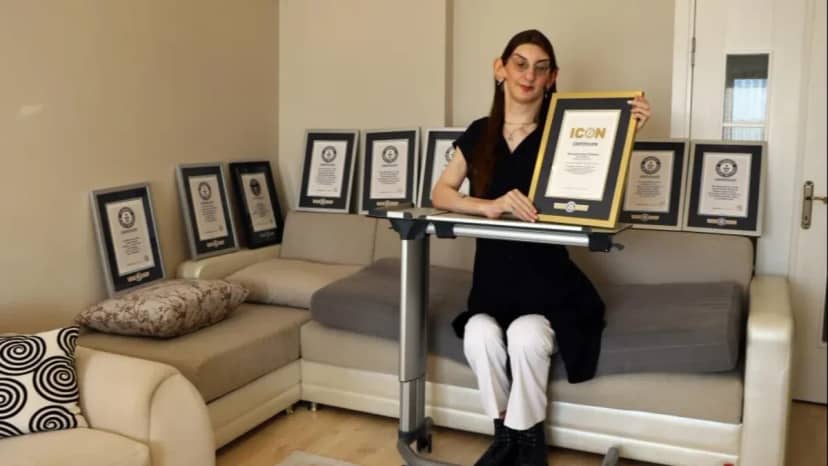 12 yılda 8 kez Guinness Rekorlar Kitabı'na girdi: Dünyanın en uzun kadını Rumeysa Gelgi tıp literatürüne ışık tutuyor