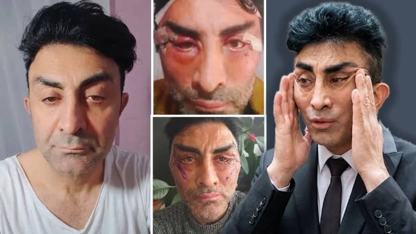 Evlilik hayaliyle gitti, tanınmayacak hale geldi! 248 bin lirasından olan adam bantsız uyuyamıyor
