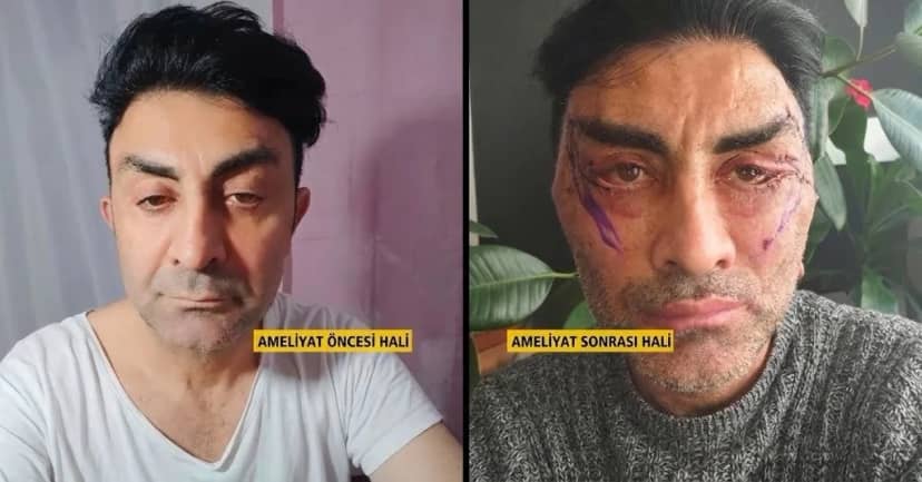 Evlilik hayaliyle gitti, tanınmayacak hale geldi! 248 bin lirasından olan adam bantsız uyuyamıyor