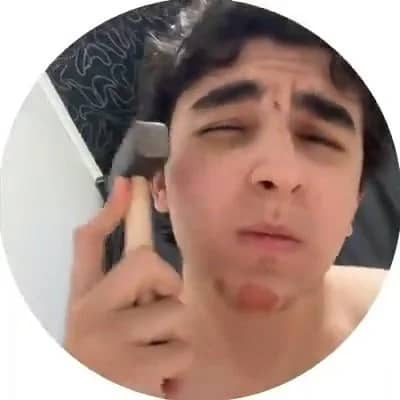 Gençlerin yeni akımı pes dedirtti! Çekici kapan yüz kemiklerini parçalıyor
