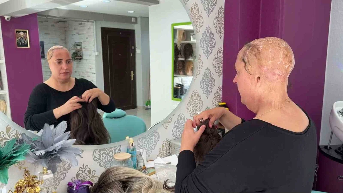 Saçlarını ve kulaklarını kaybeden Asiye Koçuk, 34 yıldır ücretsiz peruk yapıyor